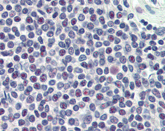 HMG20A Antibody in Immunohistochemistry (Paraffin) (IHC (P))