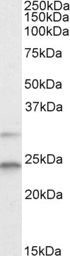 MAD2 Antibody in Western Blot (WB)