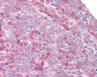 MPS1 Antibody in Immunohistochemistry (Paraffin) (IHC (P))