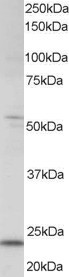 MAD4 Antibody in Western Blot (WB)