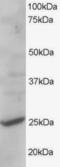 CYB561D2 Antibody in Western Blot (WB)