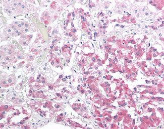 HSPB8 Antibody in Immunohistochemistry (Paraffin) (IHC (P))