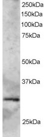 SYF2 Antibody in Western Blot (WB)