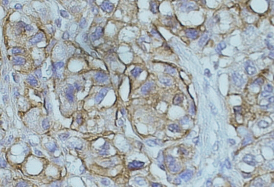 NDRG1 Antibody in Immunohistochemistry (Paraffin) (IHC (P))