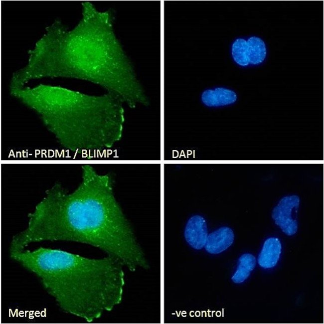 Blimp-1 Antibody in Immunocytochemistry (ICC/IF)