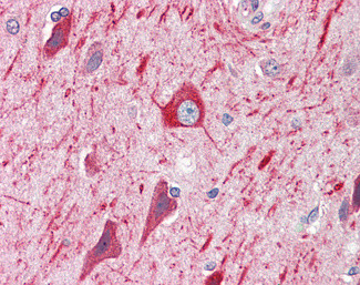 PRDM11 Antibody in Immunohistochemistry (Paraffin) (IHC (P))