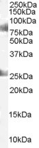 CDYL Antibody in Western Blot (WB)