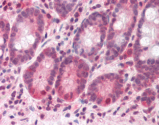 BAZ2B Antibody in Immunohistochemistry (Paraffin) (IHC (P))