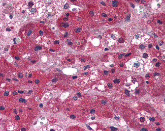 ARIH1 Antibody in Immunohistochemistry (Paraffin) (IHC (P))
