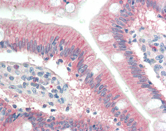 RNF39 Antibody in Immunohistochemistry (Paraffin) (IHC (P))