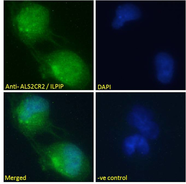ALS2CR2 Antibody in Immunocytochemistry (ICC/IF)