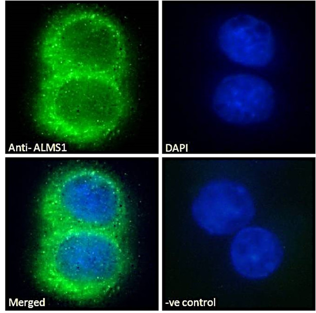 ALMS1 Antibody in Immunocytochemistry (ICC/IF)