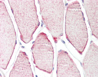 MURF3 Antibody in Immunohistochemistry (Paraffin) (IHC (P))