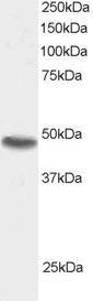 SNX15 Antibody in Western Blot (WB)