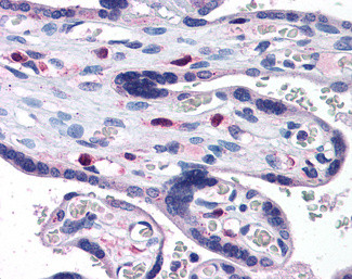 SNX16 Antibody in Immunohistochemistry (Paraffin) (IHC (P))