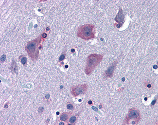TRIM2 Antibody in Immunohistochemistry (Paraffin) (IHC (P))