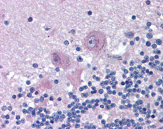 SNX26 Antibody in Immunohistochemistry (Paraffin) (IHC (P))