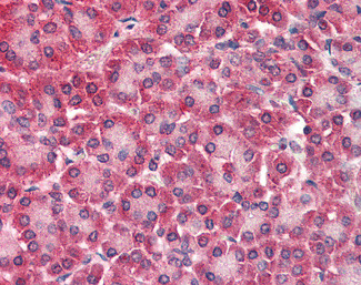 CARD6 Antibody in Immunohistochemistry (Paraffin) (IHC (P))
