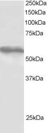 TRIM4 Antibody in Western Blot (WB)