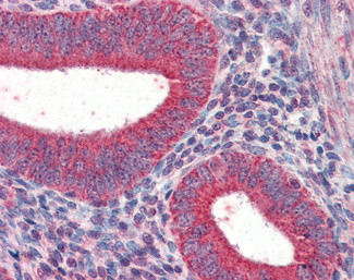 TRIM5 alpha/gamma/delta Antibody in Immunohistochemistry (Paraffin) (IHC (P))