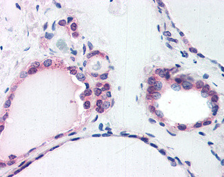 TRIP15 Antibody in Immunohistochemistry (Paraffin) (IHC (P))