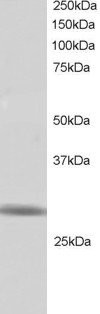 RNF141 Antibody in Western Blot (WB)