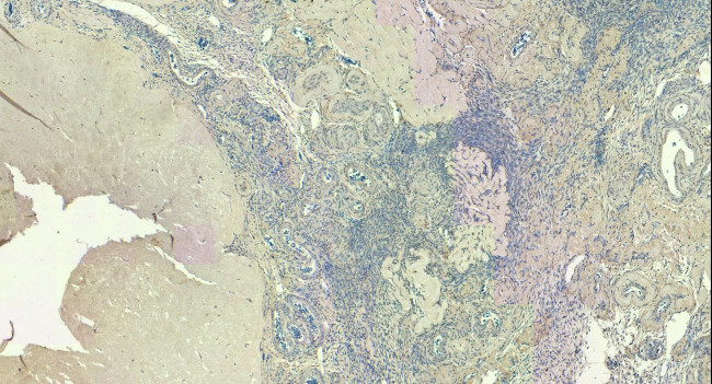 FOXL2 Antibody in Immunohistochemistry (Paraffin) (IHC (P))