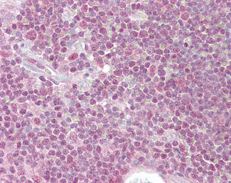 PPP1R8 Antibody in Immunohistochemistry (Paraffin) (IHC (P))