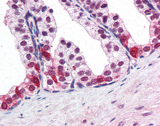 BAF57 Antibody in Immunohistochemistry (Paraffin) (IHC (P))