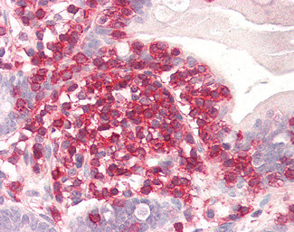 Coronin 1A Antibody in Immunohistochemistry (Paraffin) (IHC (P))