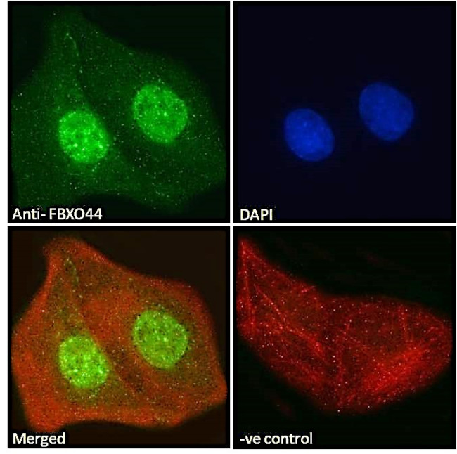 FBXO44 Antibody in Immunocytochemistry (ICC/IF)