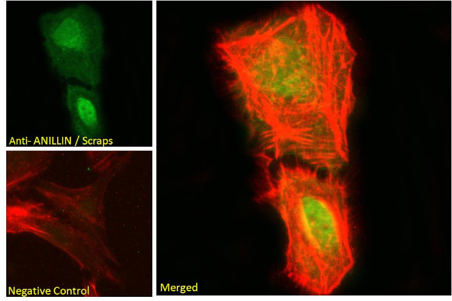 Anillin Antibody in Immunocytochemistry (ICC/IF)