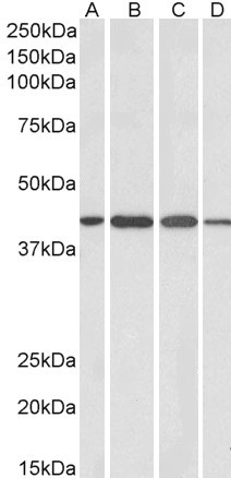 Centaurin alpha-1 Antibody in Western Blot (WB)