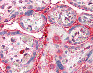 Centaurin alpha-2 Antibody in Immunohistochemistry (Paraffin) (IHC (P))