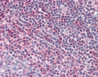 CENTB1 Antibody in Immunohistochemistry (Paraffin) (IHC (P))