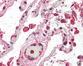 ACAP2 Antibody in Immunohistochemistry (Paraffin) (IHC (P))