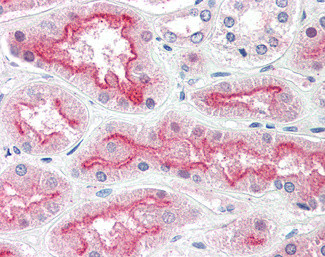 CENTG3 Antibody in Immunohistochemistry (Paraffin) (IHC (P))
