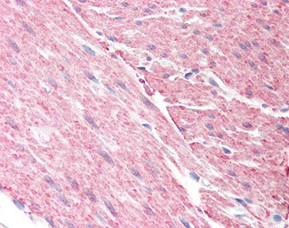 GRAF Antibody in Immunohistochemistry (Paraffin) (IHC (P))