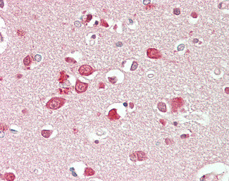 NBEA Antibody in Immunohistochemistry (Paraffin) (IHC (P))
