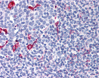 NET1 Antibody in Immunohistochemistry (Paraffin) (IHC (P))