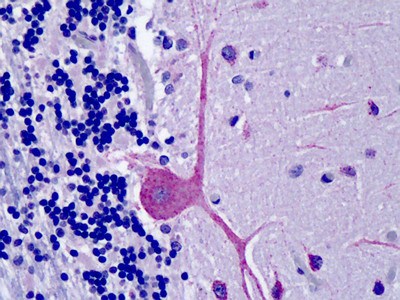 ORP1 Antibody in Immunohistochemistry (Paraffin) (IHC (P))