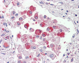 ORP9 Antibody in Immunohistochemistry (Paraffin) (IHC (P))
