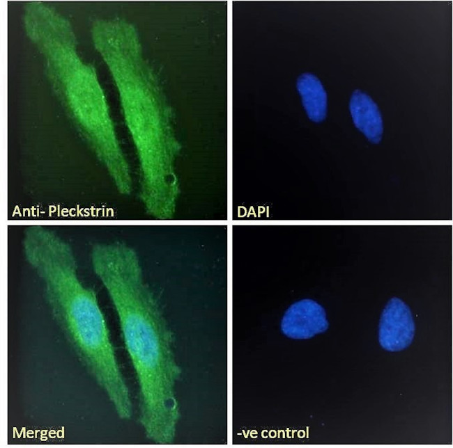 Pleckstrin Antibody in Immunocytochemistry (ICC/IF)