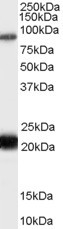 RASAL1 Antibody in Western Blot (WB)