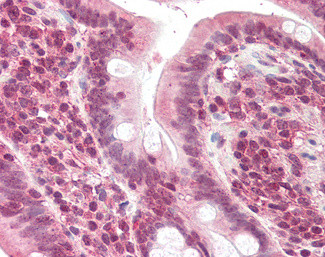 POLL Antibody in Immunohistochemistry (Paraffin) (IHC (P))