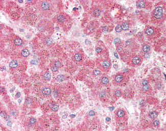 VAM1 Antibody in Immunohistochemistry (Paraffin) (IHC (P))