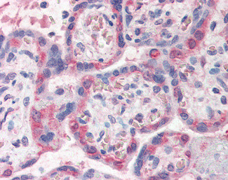 PDLIM1 Antibody in Immunohistochemistry (Paraffin) (IHC (P))