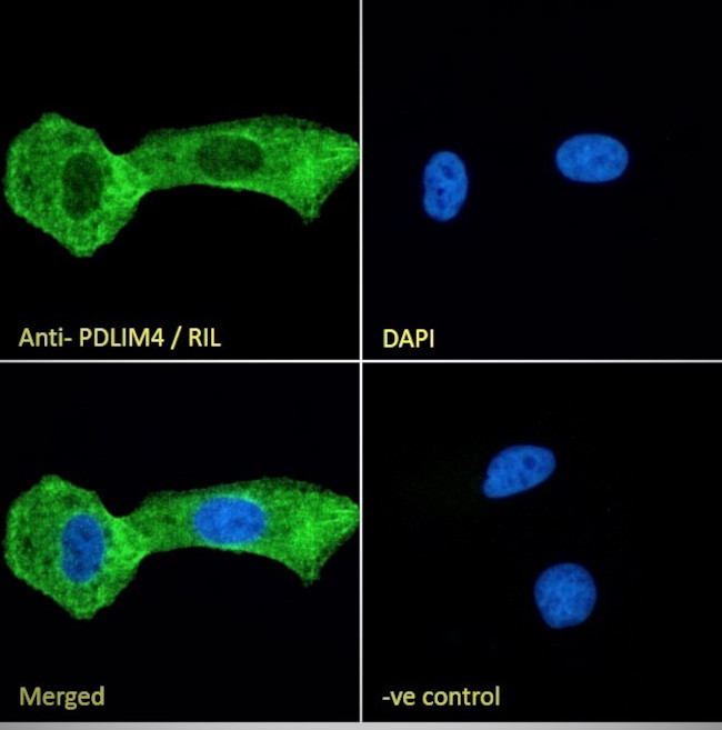 PDLIM4 Antibody in Immunocytochemistry (ICC/IF)