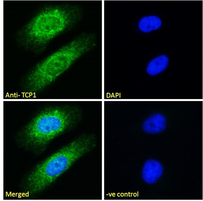 TCP1 Antibody in Immunocytochemistry (ICC/IF)