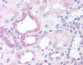 NOXO1 Antibody in Immunohistochemistry (Paraffin) (IHC (P))